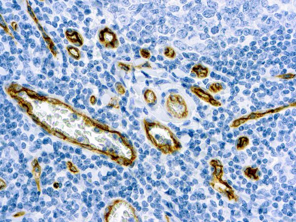 Immunohistochemical staining of CD34  of human FFPE tissue followed by incubation with HRP labeled secondary and development with DAB substrate.