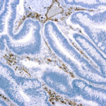 Immunohistochemical staining of CD31, Endothelial Cell  of human FFPE tissue followed by incubation with HRP labeled secondary and development with DAB substrate.