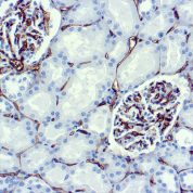 Immunohistochemical staining of CD34, Endothelial Cell  of human FFPE tissue followed by incubation with HRP labeled secondary and development with DAB substrate.