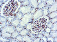 Immunohistochemical staining of CD34, Endothelial Cell  of human FFPE tissue followed by incubation with HRP labeled secondary and development with DAB substrate.