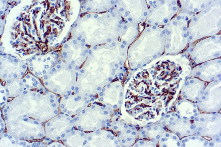 Immunohistochemical staining of CD34, Endothelial Cell  of human FFPE tissue followed by incubation with HRP labeled secondary and development with DAB substrate.
