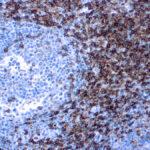 Immunohistochemical staining of CD4  of human FFPE tissue followed by incubation with HRP labeled secondary and development with DAB substrate.