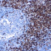 Immunohistochemical staining of CD4  of human FFPE tissue followed by incubation with HRP labeled secondary and development with DAB substrate.