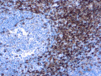 Immunohistochemical staining of CD4  of human FFPE tissue followed by incubation with HRP labeled secondary and development with DAB substrate.