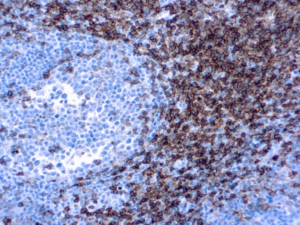 Immunohistochemical staining of CD4  of human FFPE tissue followed by incubation with HRP labeled secondary and development with DAB substrate.