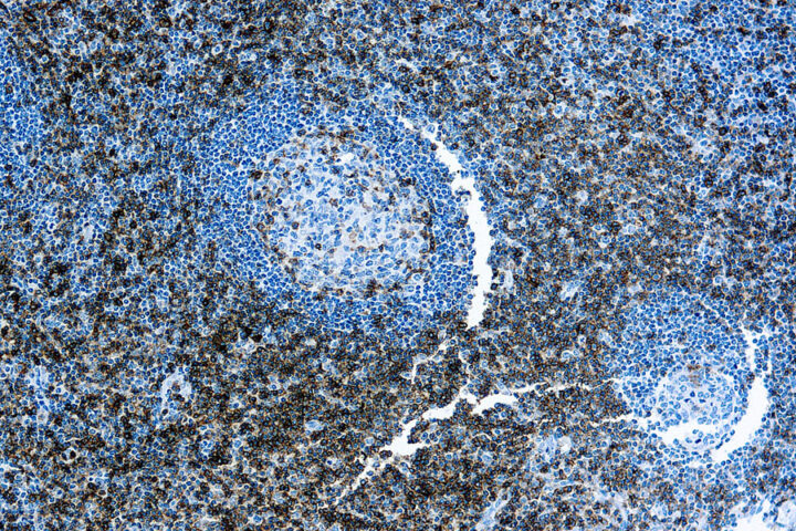 Immunohistochemical staining of CD43, T Cell  of human FFPE tissue followed by incubation with HRP labeled secondary and development with DAB substrate.