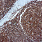 Immunohistochemical staining of CD45  of human FFPE tissue followed by incubation with HRP labeled secondary and development with DAB substrate.