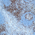 Immunohistochemical staining of CD45RO, T Cell  of human FFPE tissue followed by incubation with HRP labeled secondary and development with DAB substrate.