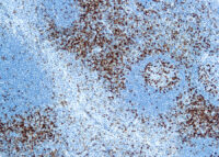 Immunohistochemical staining of CD45RO, T Cell  of human FFPE tissue followed by incubation with HRP labeled secondary and development with DAB substrate.