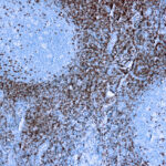 Immunohistochemical staining of CD5  of human FFPE tissue followed by incubation with HRP labeled secondary and development with DAB substrate.