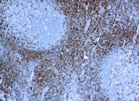 Immunohistochemical staining of CD5  of human FFPE tissue followed by incubation with HRP labeled secondary and development with DAB substrate.