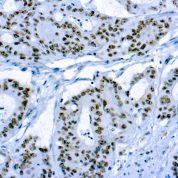 Immunohistochemical staining of CD56/Neural Cell Adhesion Molecule-1  of human FFPE tissue followed by incubation with HRP labeled secondary and development with DAB substrate.
