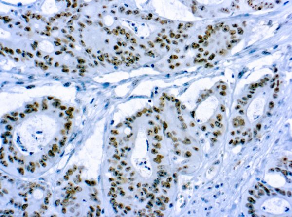 Immunohistochemical staining of CD56/Neural Cell Adhesion Molecule-1  of human FFPE tissue followed by incubation with HRP labeled secondary and development with DAB substrate.
