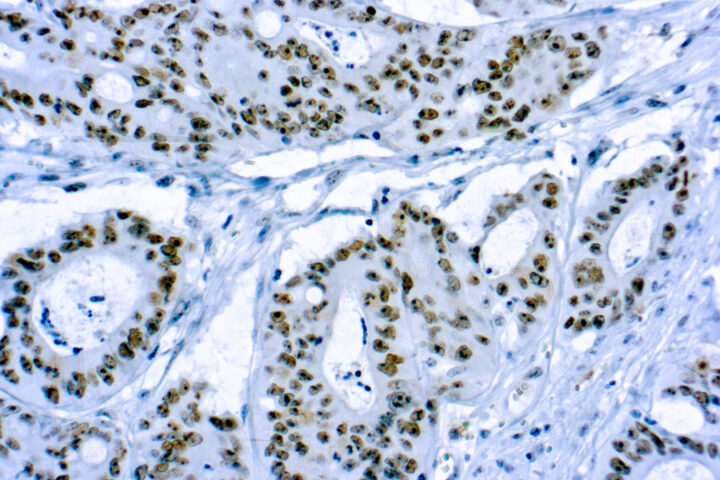 Immunohistochemical staining of CD56/Neural Cell Adhesion Molecule-1  of human FFPE tissue followed by incubation with HRP labeled secondary and development with DAB substrate.