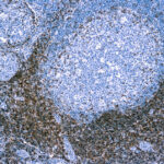 Immunohistochemical staining of CD5  of human FFPE tissue followed by incubation with HRP labeled secondary and development with DAB substrate.