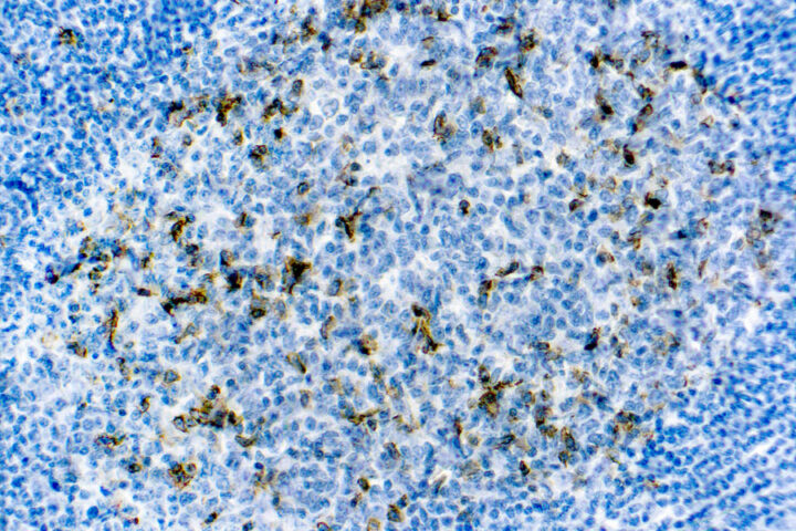 Immunohistochemical staining of CD57  of human FFPE tissue followed by incubation with HRP labeled secondary and development with DAB substrate.