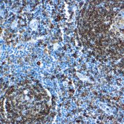 Immunohistochemical staining of CD74, Lymphoid Marker  of human FFPE tissue followed by incubation with HRP labeled secondary and development with DAB substrate.