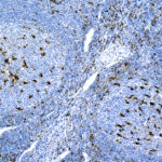 Immunohistochemical staining of CD68, Macrophage  of human FFPE tissue followed by incubation with HRP labeled secondary and development with DAB substrate.