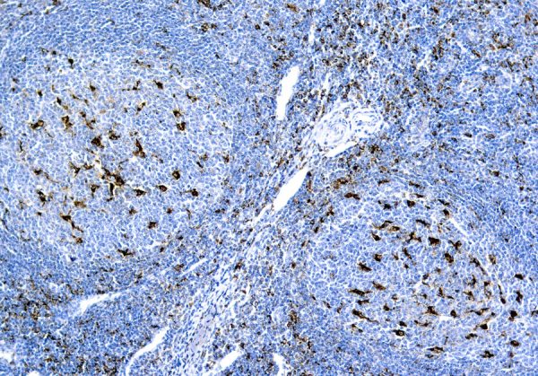 Immunohistochemical staining of CD68, Macrophage  of human FFPE tissue followed by incubation with HRP labeled secondary and development with DAB substrate.