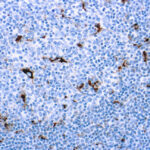 Immunohistochemical staining of CD68, Macrophage  of human FFPE tissue followed by incubation with HRP labeled secondary and development with DAB substrate.