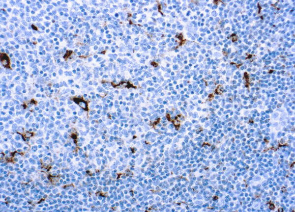 Immunohistochemical staining of CD68, Macrophage  of human FFPE tissue followed by incubation with HRP labeled secondary and development with DAB substrate.