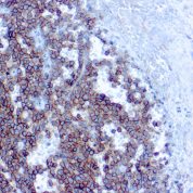Immunohistochemical staining of CD99/MIC2, Ewing's Sarcoma Marker  of human FFPE tissue followed by incubation with HRP labeled secondary and development with DAB substrate.