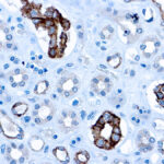 Immunohistochemical staining of CD63  of human FFPE tissue followed by incubation with HRP labeled secondary and development with DAB substrate.