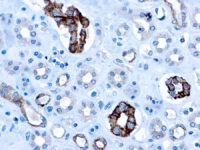 Immunohistochemical staining of CD63  of human FFPE tissue followed by incubation with HRP labeled secondary and development with DAB substrate.