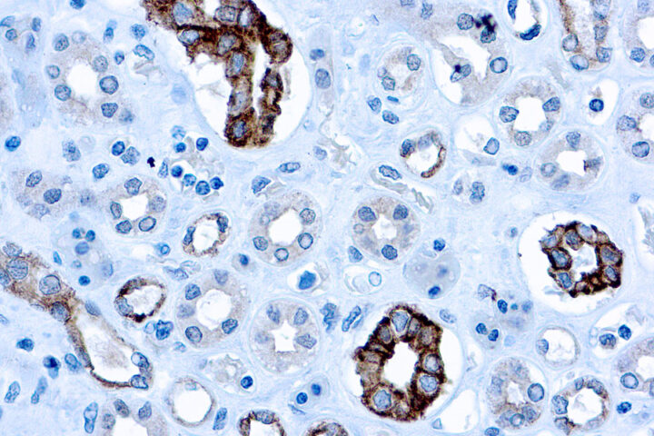 Immunohistochemical staining of CD63  of human FFPE tissue followed by incubation with HRP labeled secondary and development with DAB substrate.