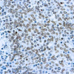 Immunohistochemical staining of Cdc25A  of human FFPE tissue followed by incubation with HRP labeled secondary and development with DAB substrate.