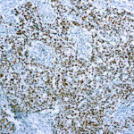 Immunohistochemical staining of Cdc47/MCM7  of human FFPE tissue followed by incubation with HRP labeled secondary and development with DAB substrate.