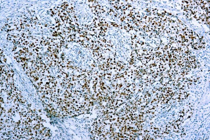 Immunohistochemical staining of Cdc47/MCM7  of human FFPE tissue followed by incubation with HRP labeled secondary and development with DAB substrate.