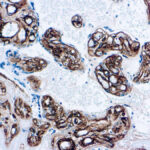 Immunohistochemical staining of Collagen Type IV  of human FFPE tissue followed by incubation with HRP labeled secondary and development with DAB substrate.