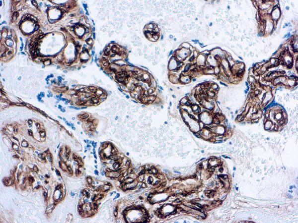 Immunohistochemical staining of Collagen Type IV  of human FFPE tissue followed by incubation with HRP labeled secondary and development with DAB substrate.