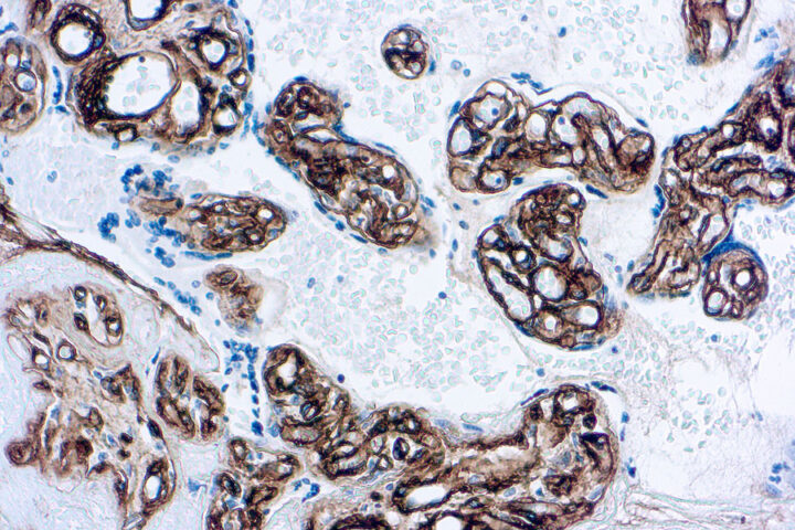 Immunohistochemical staining of Collagen Type IV  of human FFPE tissue followed by incubation with HRP labeled secondary and development with DAB substrate.