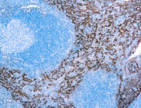 Immunohistochemical staining of Cytokeratin 5/14  of human FFPE tissue followed by incubation with HRP labeled secondary and development with DAB substrate.