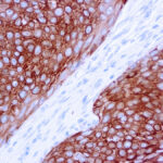 Immunohistochemical staining of Cytokeratin 5/6  of human FFPE tissue followed by incubation with HRP labeled secondary and development with DAB substrate.