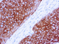 Immunohistochemical staining of Cytokeratin 5/6  of human FFPE tissue followed by incubation with HRP labeled secondary and development with DAB substrate.