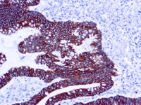 Immunohistochemical staining of Cytokeratin 8/18  of human FFPE tissue followed by incubation with HRP labeled secondary and development with DAB substrate.