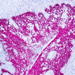 Immunohistochemical staining of Cytokeratin, High Molecular Weight  of human FFPE tissue followed by incubation with HRP labeled secondary and development with DAB substrate.