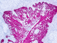 Immunohistochemical staining of Cytokeratin, High Molecular Weight  of human FFPE tissue followed by incubation with HRP labeled secondary and development with DAB substrate.