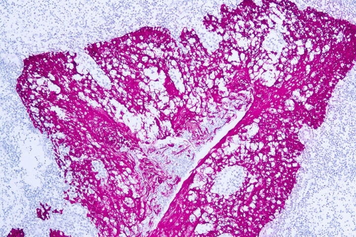 Immunohistochemical staining of Cytokeratin, High Molecular Weight  of human FFPE tissue followed by incubation with HRP labeled secondary and development with DAB substrate.