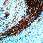 Immunohistochemical staining of Cytokeratin, Acidic  of human FFPE tissue followed by incubation with HRP labeled secondary and development with DAB substrate.