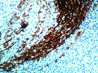 Immunohistochemical staining of Cytokeratin, Acidic  of human FFPE tissue followed by incubation with HRP labeled secondary and development with DAB substrate.