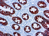 Immunohistochemical staining of Cytokeratin 8, Low Molecular Weight  of human FFPE tissue followed by incubation with HRP labeled secondary and development with DAB substrate.