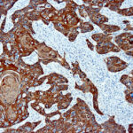 Immunohistochemical staining of Cytokeratin, Basic  of human FFPE tissue followed by incubation with HRP labeled secondary and development with DAB substrate.