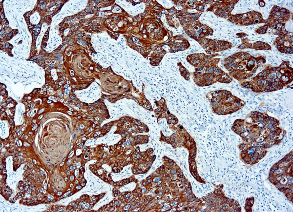 Immunohistochemical staining of Cytokeratin, Basic  of human FFPE tissue followed by incubation with HRP labeled secondary and development with DAB substrate.