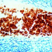 Immunohistochemical staining of Glycophorin A  of human FFPE tissue followed by incubation with HRP labeled secondary and development with DAB substrate.