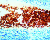 Immunohistochemical staining of Glycophorin A  of human FFPE tissue followed by incubation with HRP labeled secondary and development with DAB substrate.