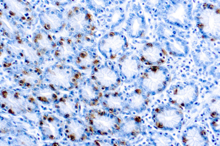 Immunohistochemical staining of Gastrin  of human FFPE tissue followed by incubation with HRP labeled secondary and development with DAB substrate.